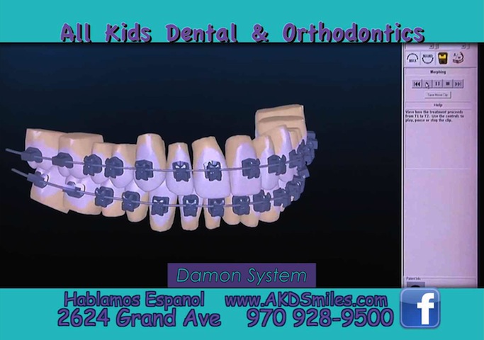 All Kids Dental